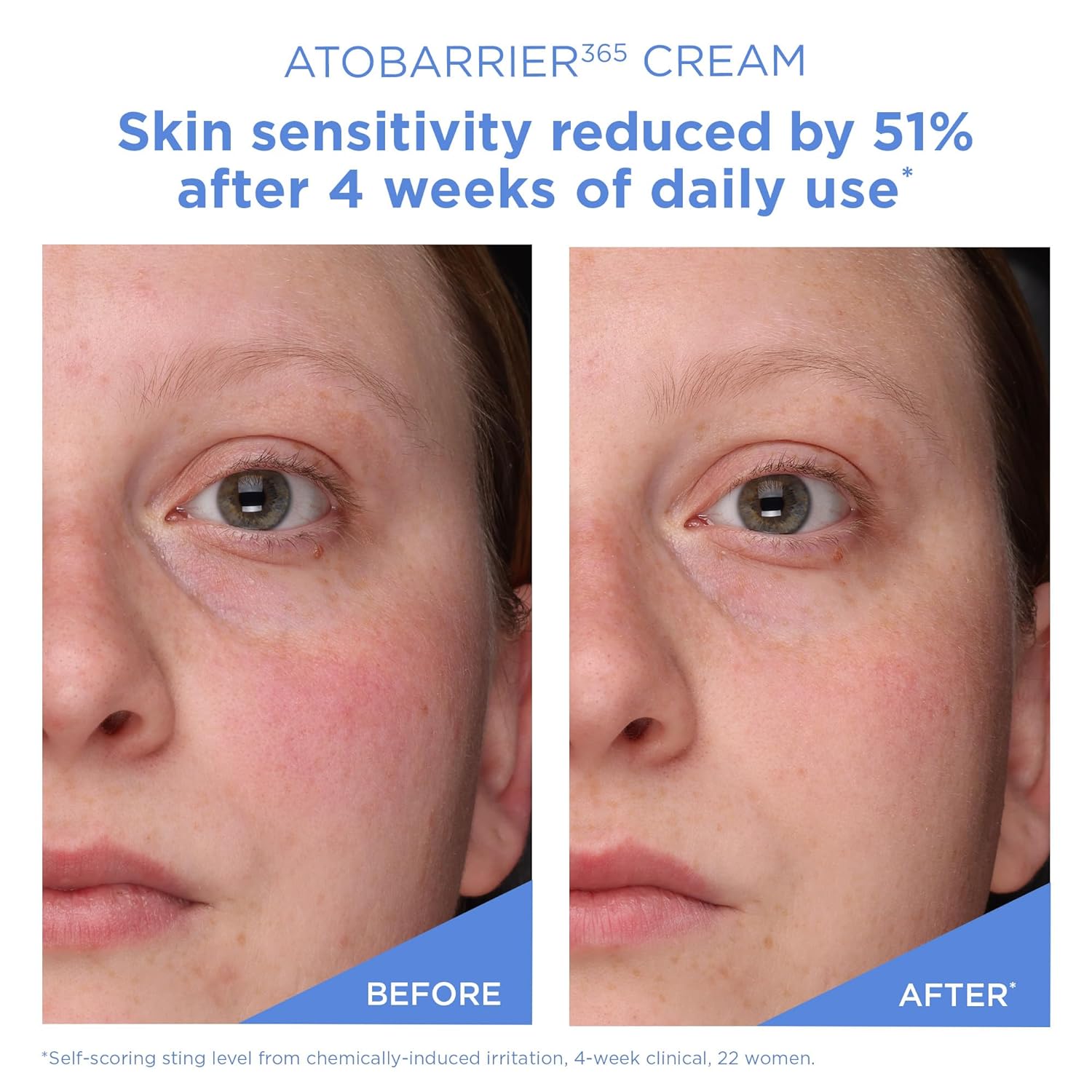 Atobarrier 365 Cream 80mL AESTURA