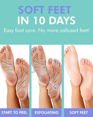 Foot Peeling Mask- Exfoliating AHA BHA PHA Foot Care DERMAL