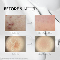 Reedle Shot 100 50ml