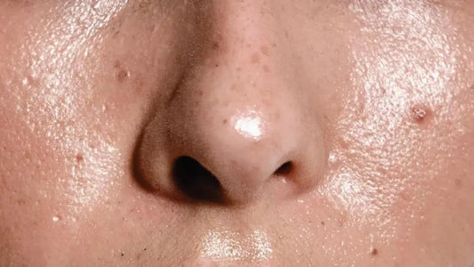 Sommerens guide til talgkontroll WEshine.no