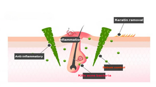 Den komplette guiden til Spicule – Naturlige mikronåler fra havet